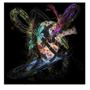 Inner Ear
